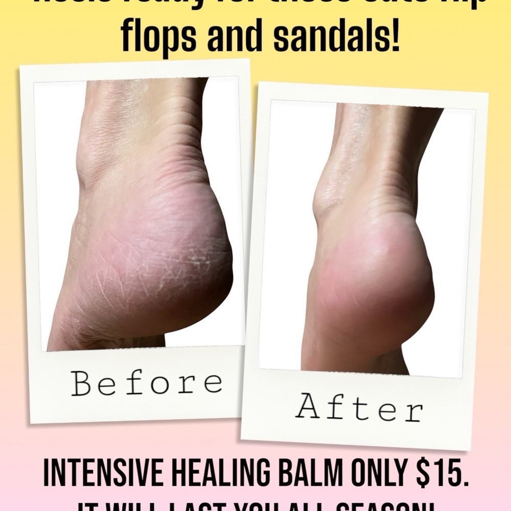 Intensive Repair Dry Skin Healing Balm